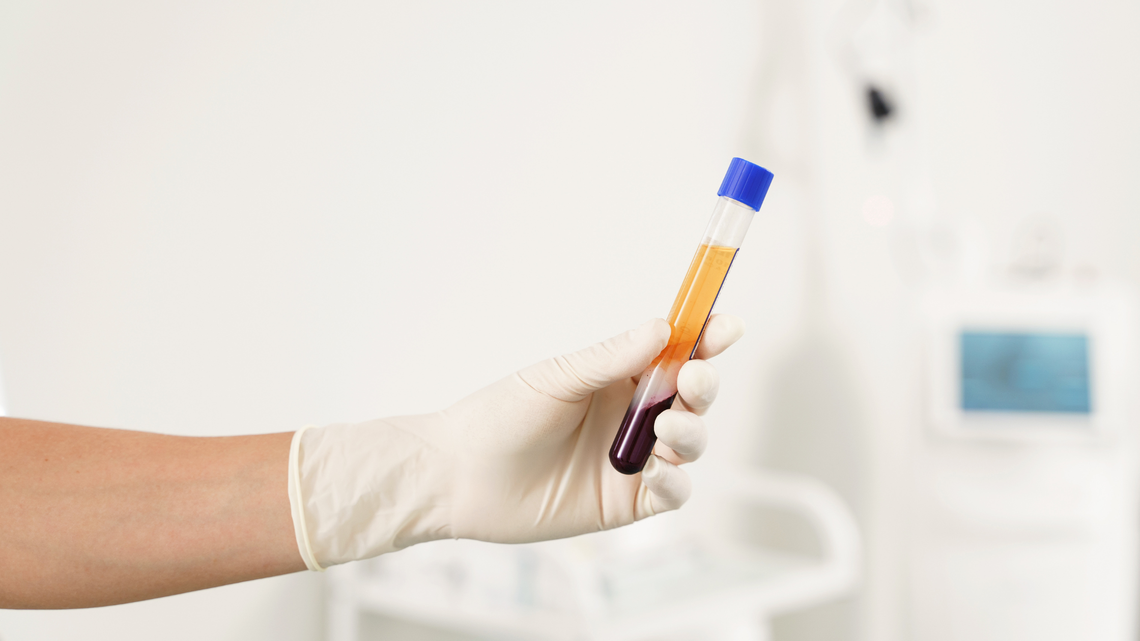 PRP and Cell Therapy for Joint Pain