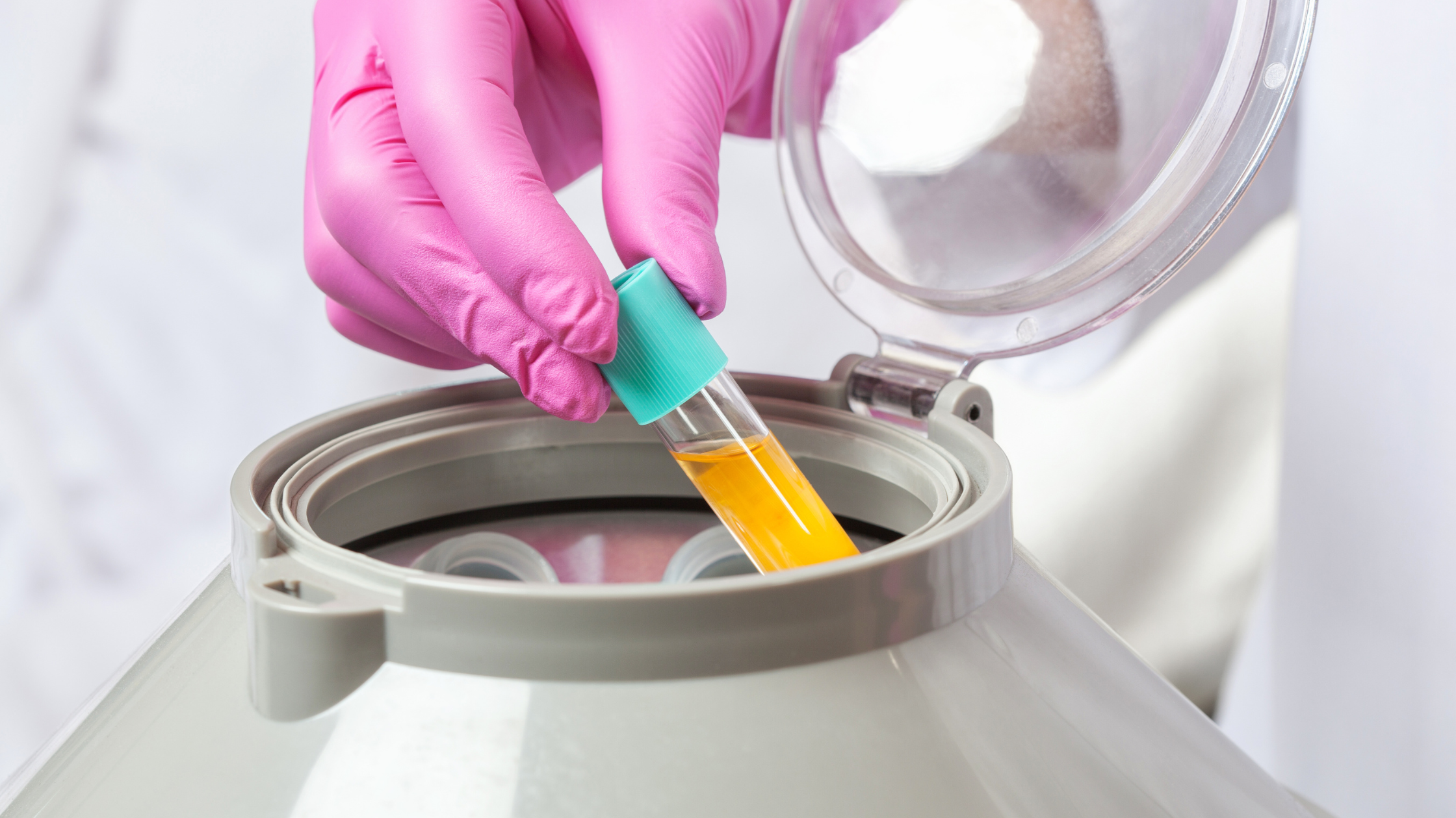 PRP therapy
