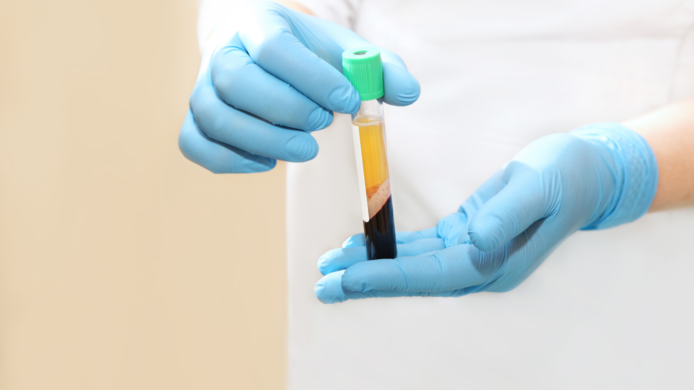 PRP therapy for tendon pain